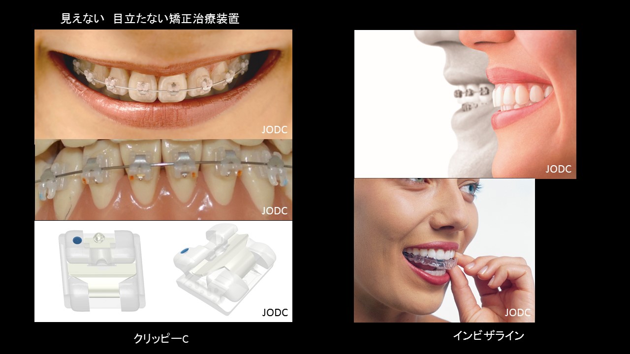 純 矯正・歯科クリニック