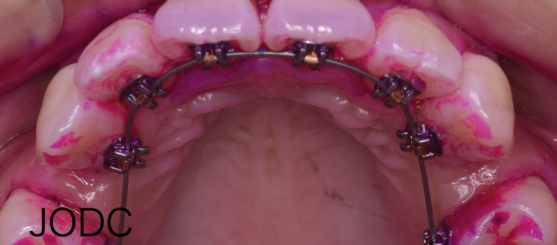 純 矯正 歯科クリニック