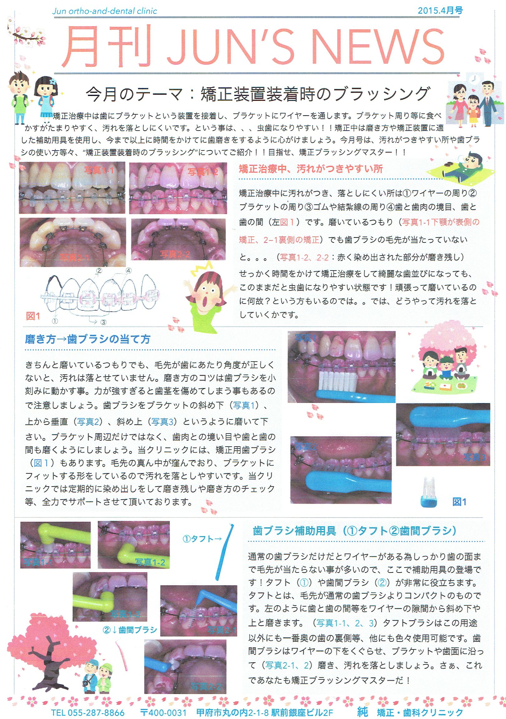 Jun S News Vol 9 テーマ 矯正装置装着時のブラッシング 甲府市の矯正歯科 純矯正歯科クリニック