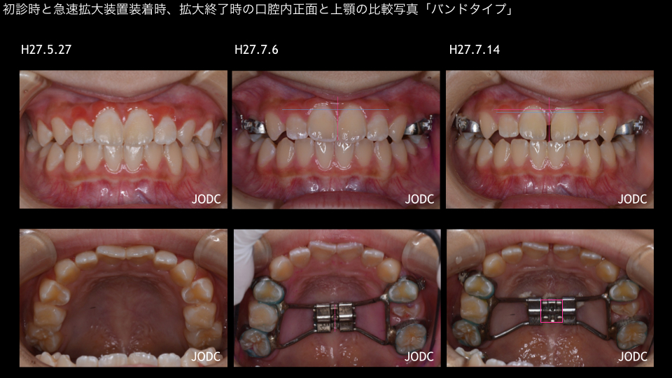 純 矯正 歯科クリニック