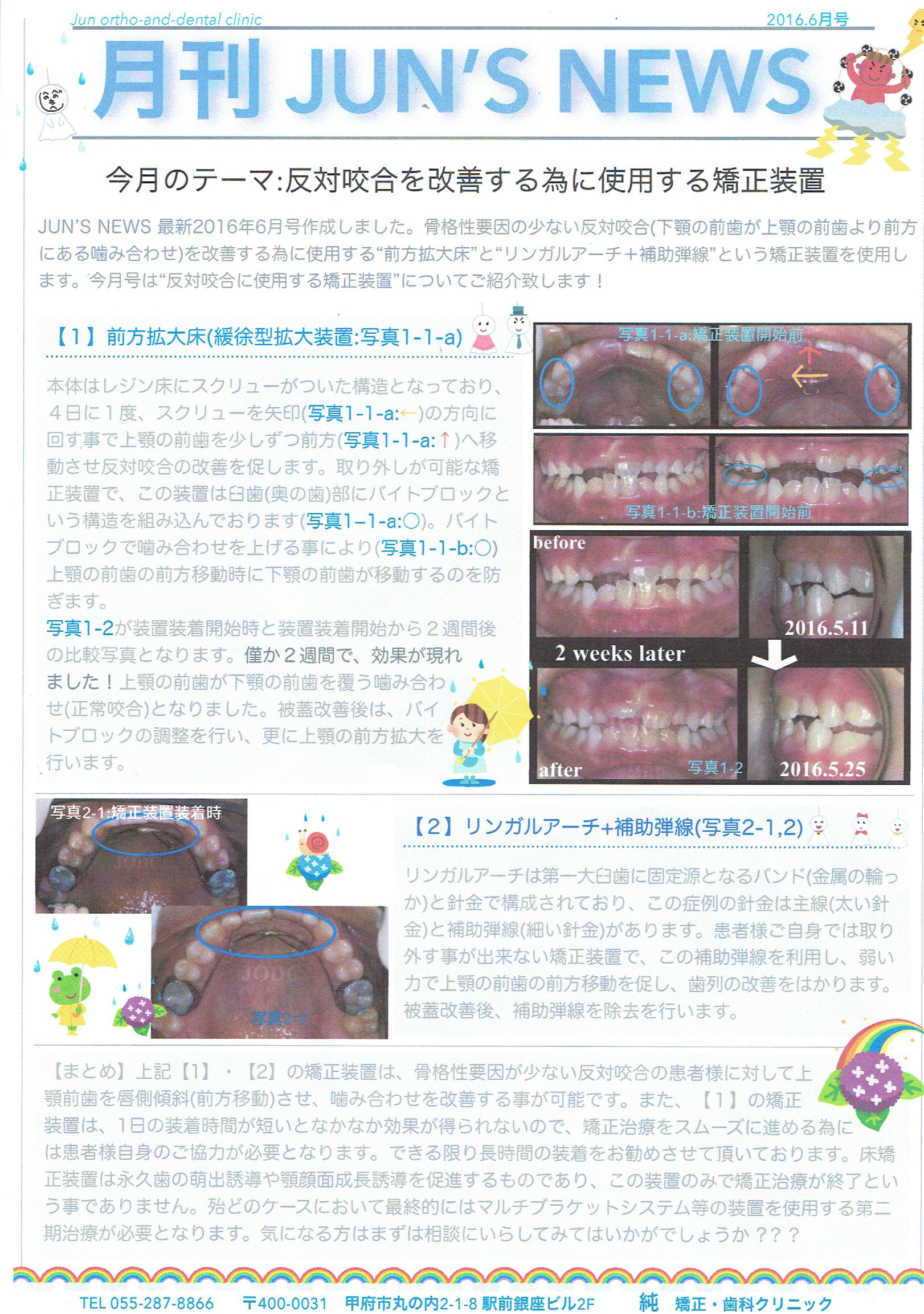 新　矯正装置ビジュアルガイド（値下げ交渉承ります。） 光加速装置PBM | イースト21デンタルオフィス